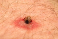 Най-опасните и смъртоносни животни и вредители в България - Бран Инсект