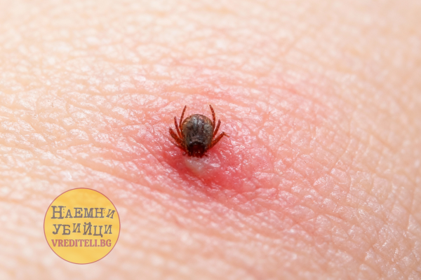 Кърлеж впит в човешка кожа